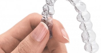 Invisalign: A Modern, Invisible Solution to Metal Braces Invisalign Ottawa